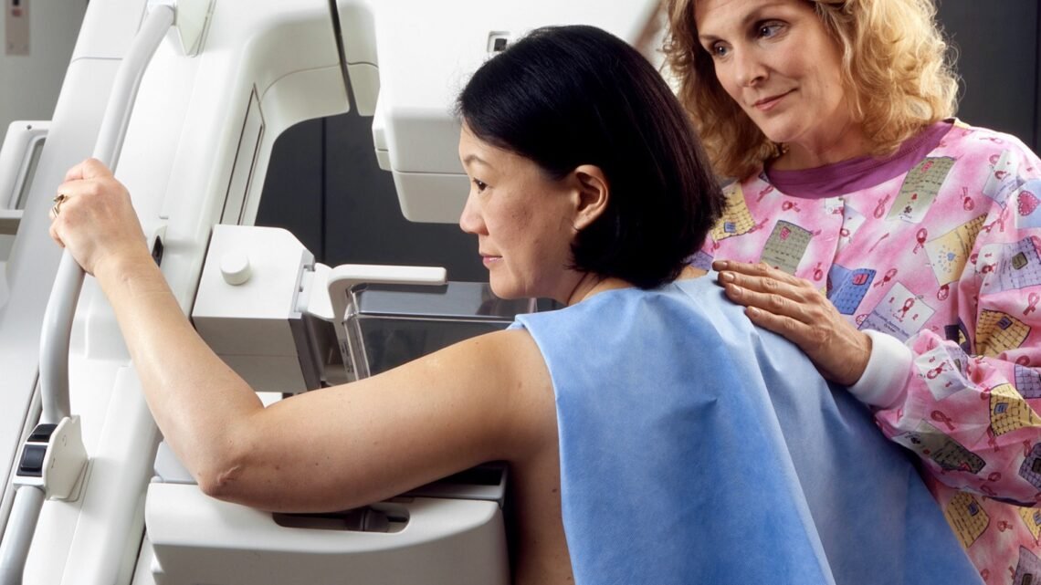 Mulher de perfil realizando exame em aparelho de mamografia com apoio de uma profissional de saúde. Foco no diagnóstico precoce do câncer de mama.