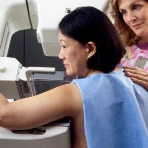 Mulher de perfil realizando exame em aparelho de mamografia com apoio de uma profissional de saúde. Foco no diagnóstico precoce do câncer de mama.